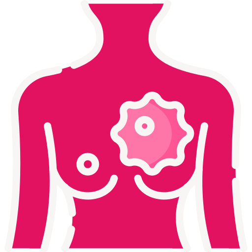 Fibroadenoma